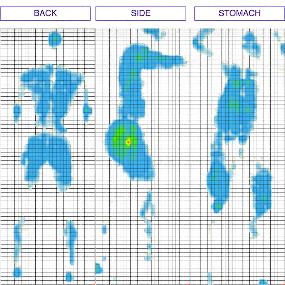 Tuck Mattress Pressure Map