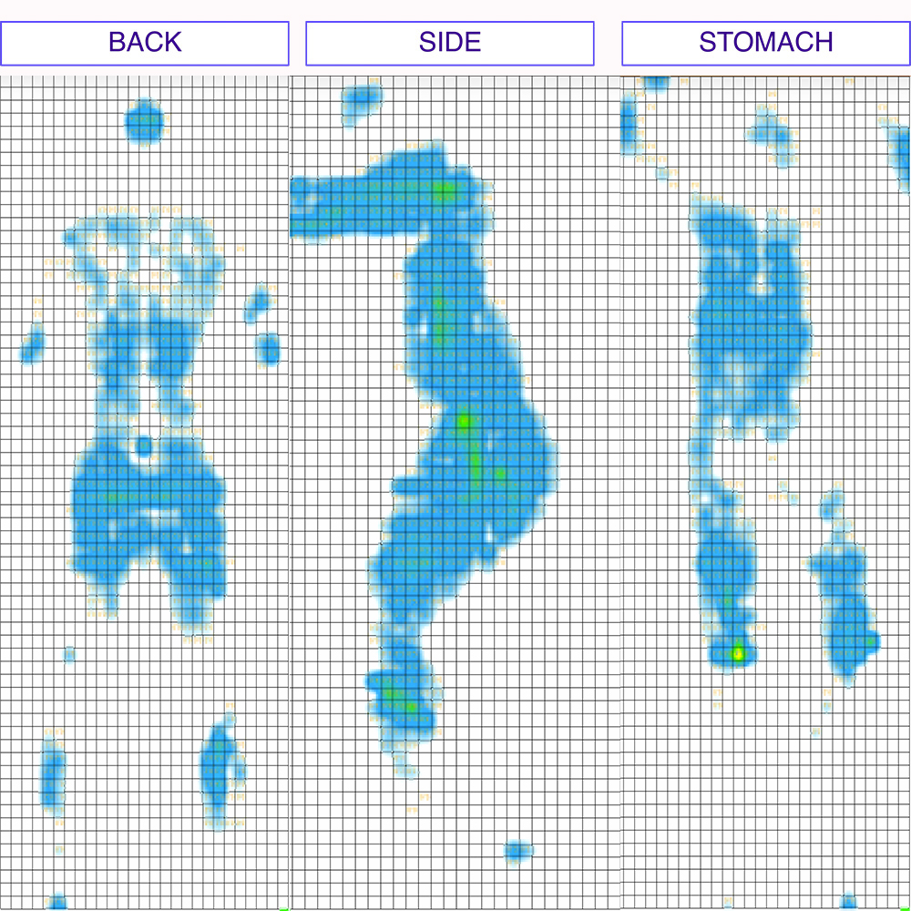 Brooklyn Signature Pressure Map