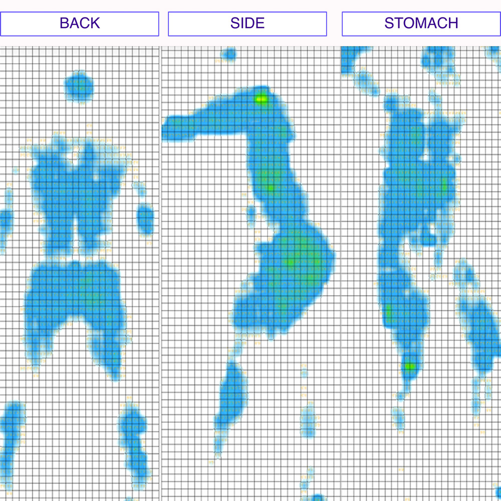 Nest Alexander Signature Hybrid Pressure Map
