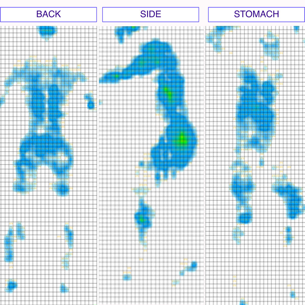 WinkBed Plus mattress pressure map