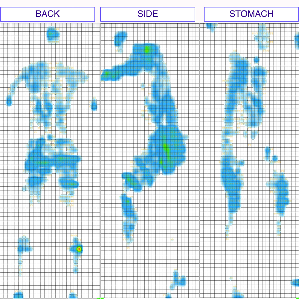 Zotto Pressure Map