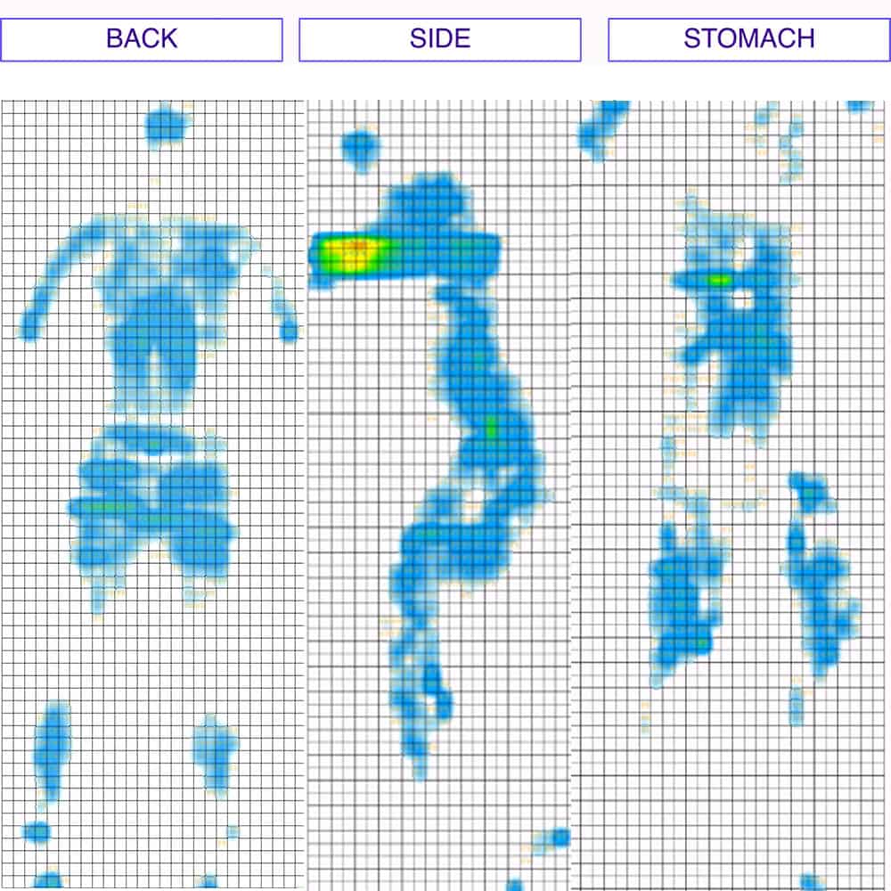 Blello Mattress Pressure Map