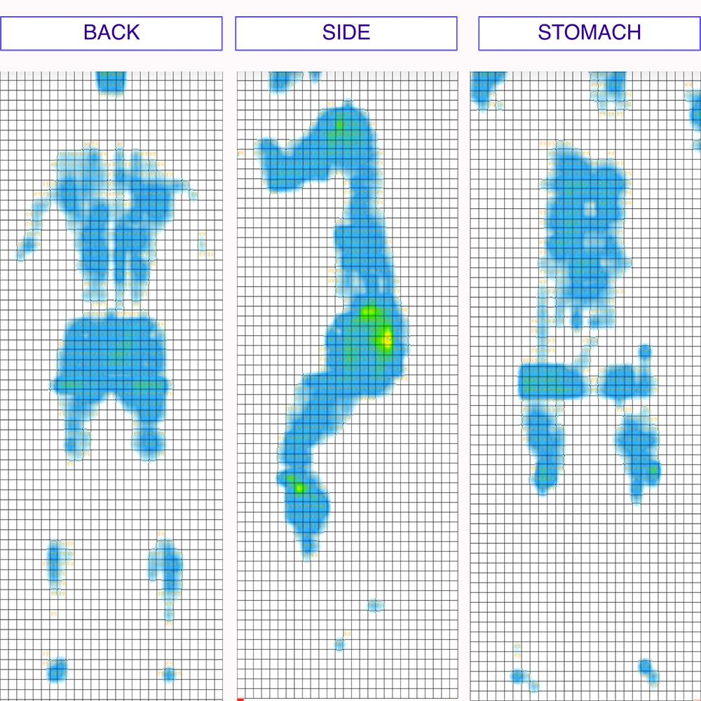 Morphiis Pressure Map