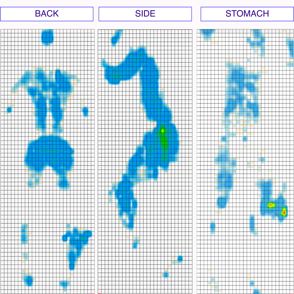 Tranquillium Pressure Map