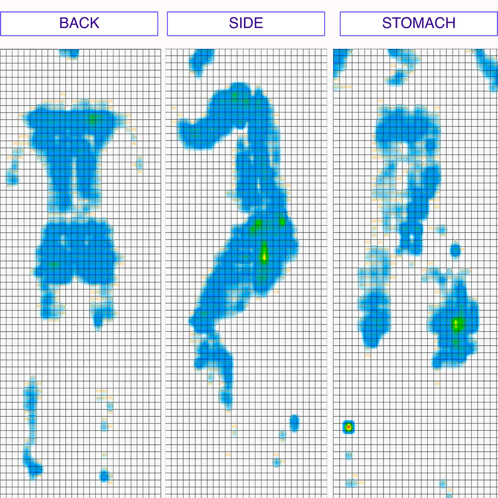 Zonkd Pressure Map