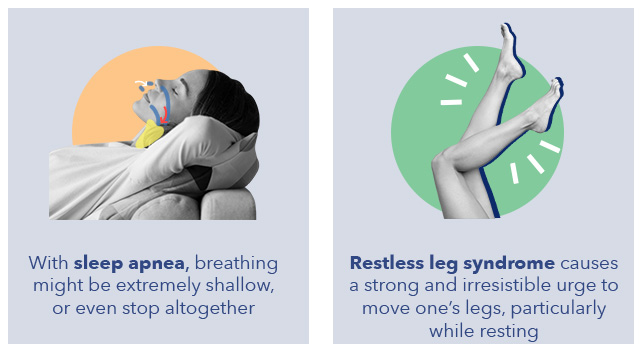 SO Hypersomnia OtherSleepDisorders