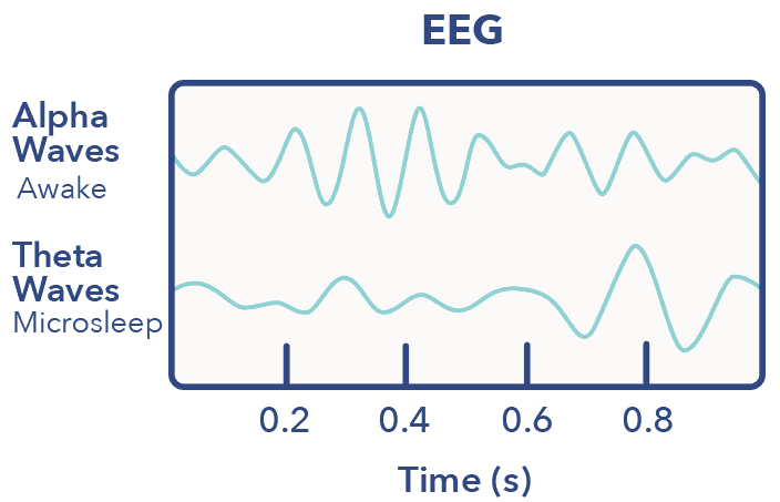 SO MicrosleepArticleGraphics EEG