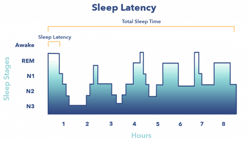 N1: Non Rapid-Eye Movement Sleep, Stage 1 | Sleepopolis