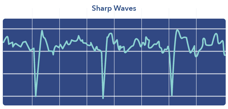 no slow wave sleep