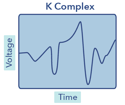 SO SleepStagesGraphics2 K Complex