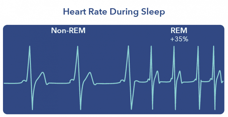 Why Does My Heart Rate Increase While Sleeping