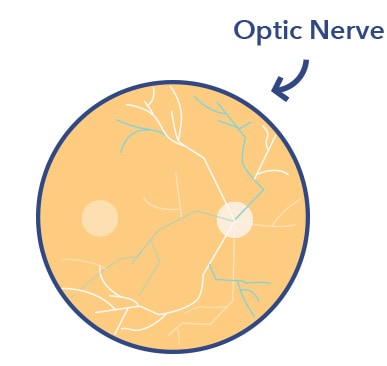 sleep and the brain optic nerve