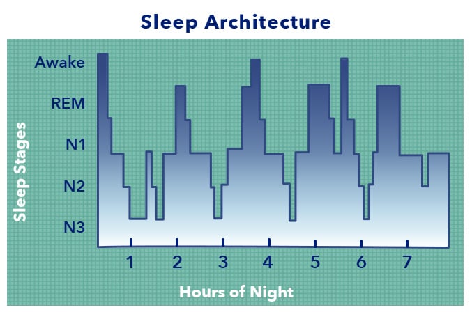 what is sleep sleep architecture