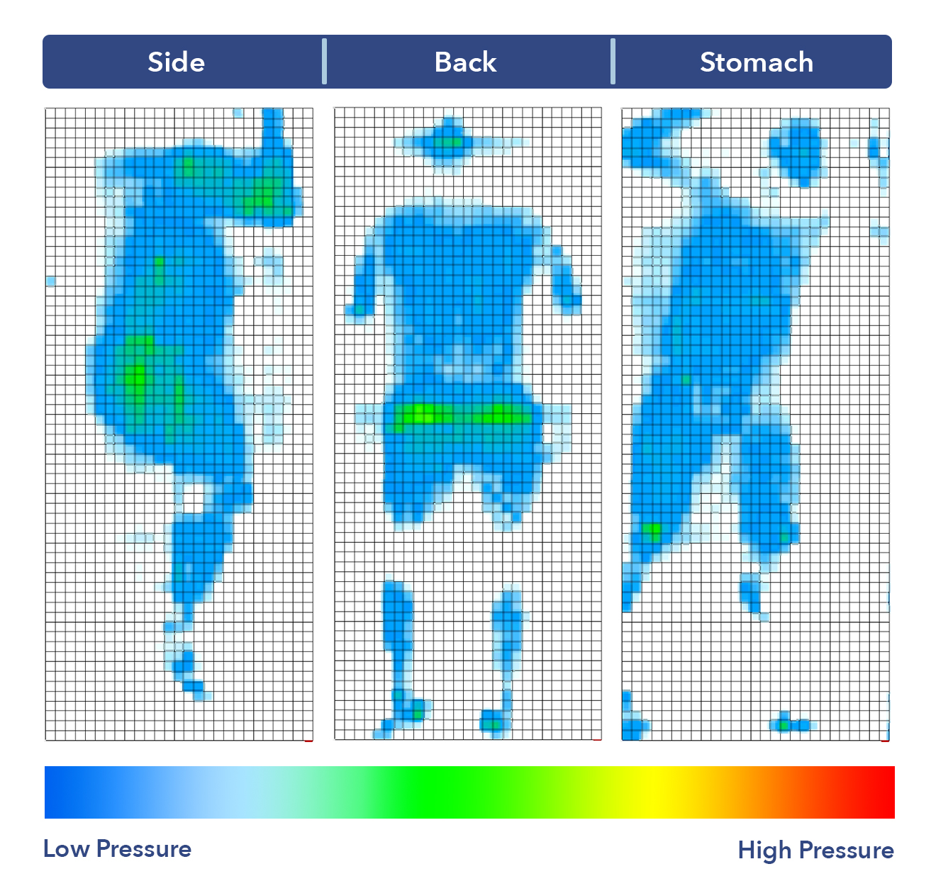 Zoma Hybrid Pressure Relief