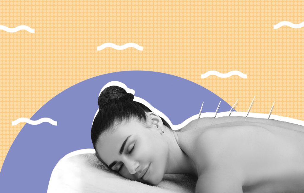 Can Acupuncture Help You Sleep?