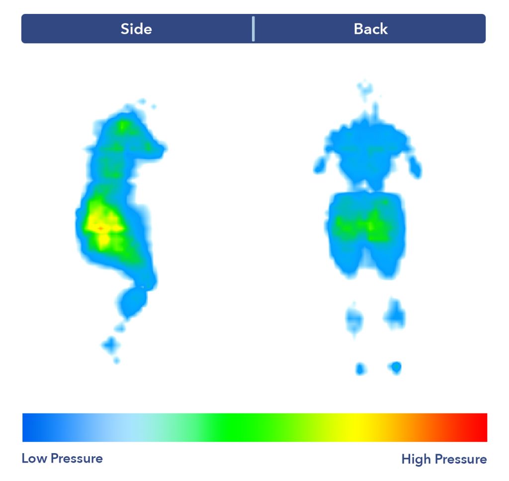 Side-by-side images of our pressure map for the Big Fig. It shows a thermal graphic of someone lying on their side and their back. The map is mostly blue, with patches of green and yellow at the hips in the side-sleeping position.