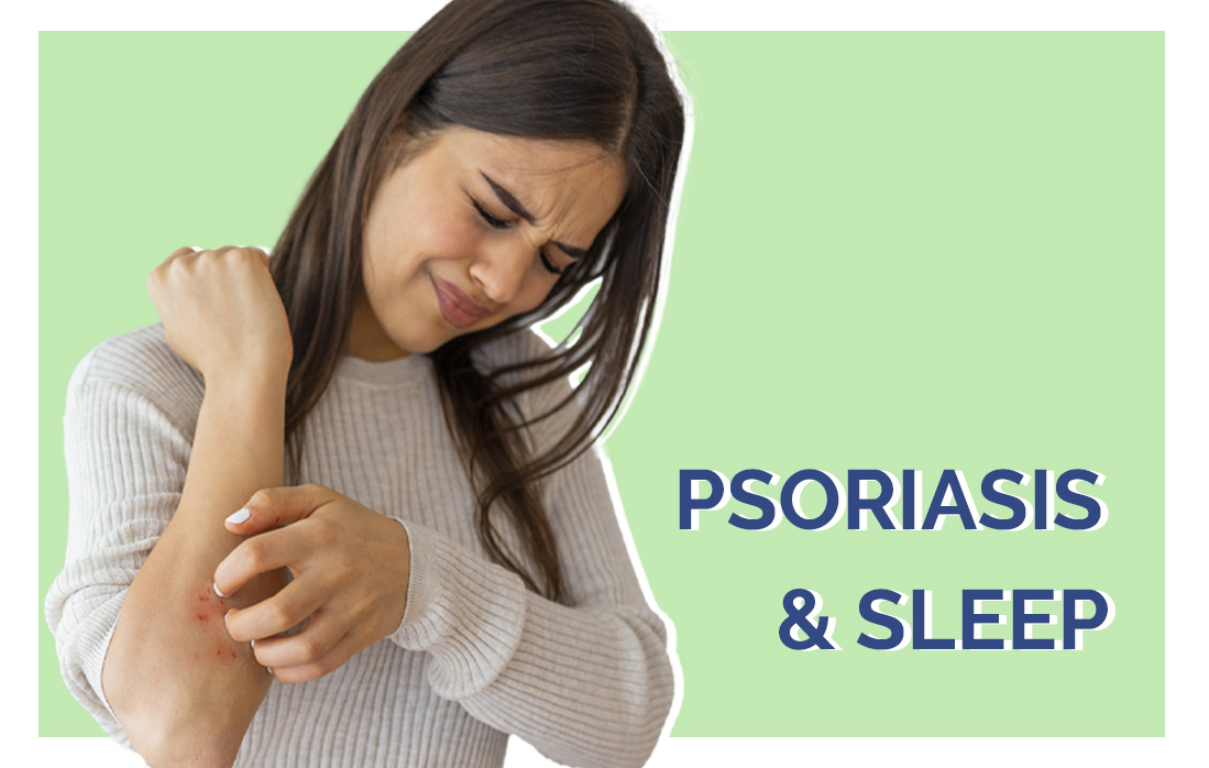 Psoriasis and Sleep