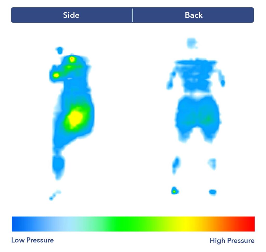 Side-by-side images of our pressure map for the Brooklyn Bedding Aurora Luxe. It shows a thermal graphic of someone lying on their side and their back. The map is mostly blue in the back-sleeping position, with patches of green and yellow at the hips, and a spot of red at the shoulders in the side-sleeping position.