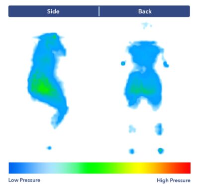 Side-by-side images of our pressure map for the Leesa Sapira Chill. It shows a thermal graphic of someone lying on their side and their back. The map is mostly blue, with patches of green at the hips in the side-sleeping position.