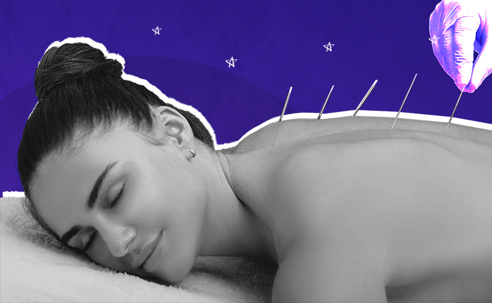 acupuncture for sleep