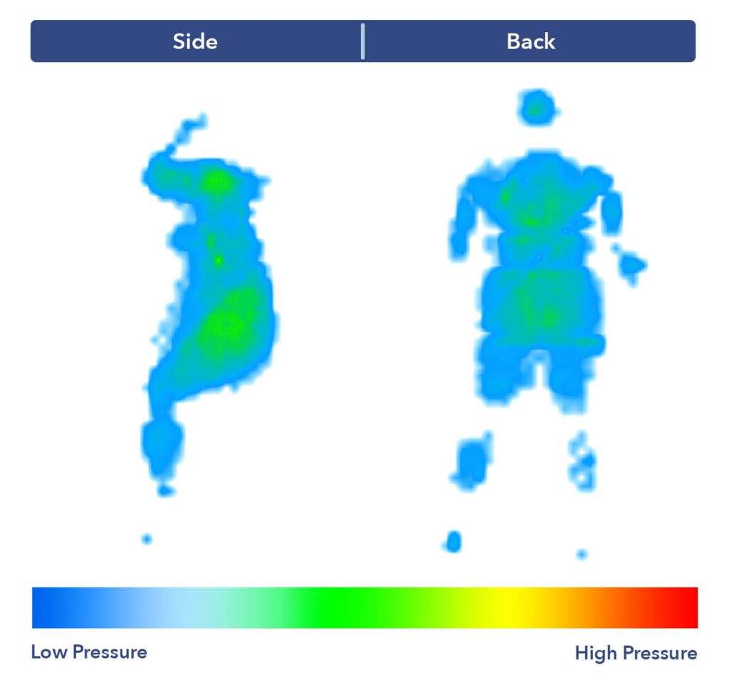 PressureMap WinkBed Blue Series 2