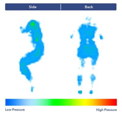 Side-by-side images of our pressure map for the Bear Elite Hybrid. It shows a thermal graphic of someone lying on their side and their back. The map is mostly blue, with a spot of green at the shoulders in the side-sleeping position.