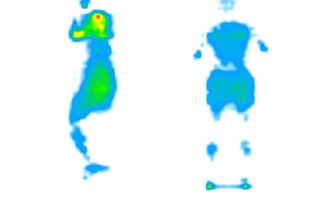 Side-by-side images of our pressure map for the DreamCloud Premier. It shows a thermal graphic of someone lying on their side and their back. The map is mostly blue in the back-sleeping position, with patches of green at the hips, and yellow and red at the shoulders in the side-sleeping position.