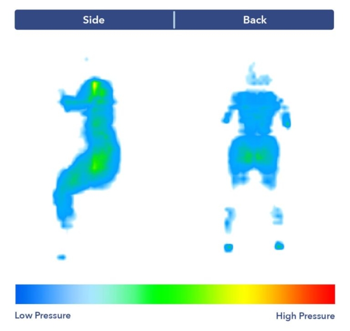 Our pressure map showing a graphic that's nearly all blue, indicating little to no pressure buildup in the back-sleeping position. On my side, there's more green and yellow, especially around my hips and shoulders. 