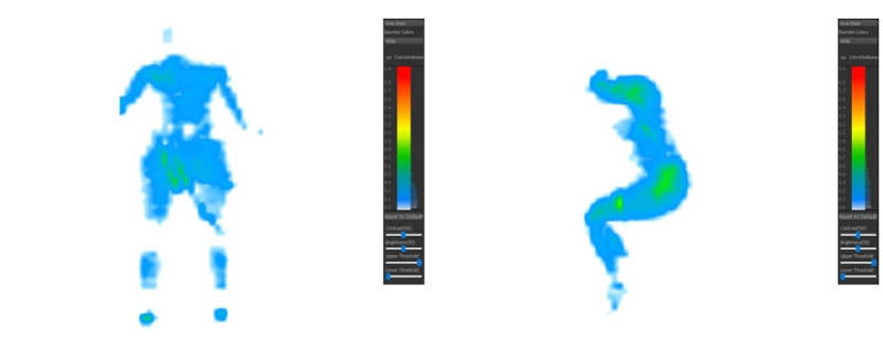 Two pressure map graphics, which show the outline of a body and how much pressure is being put on it by the mattress, using color-coded imaging.