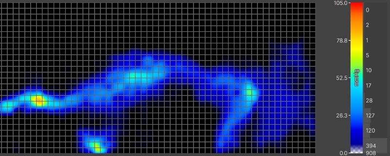 Pressure map of our Average-weight tester side-sleeping on a Helix Midnight Luxe mattress.
